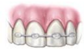 Traumatic Dental Injuries & Trauma to the Teeth - endodontics | bartram park